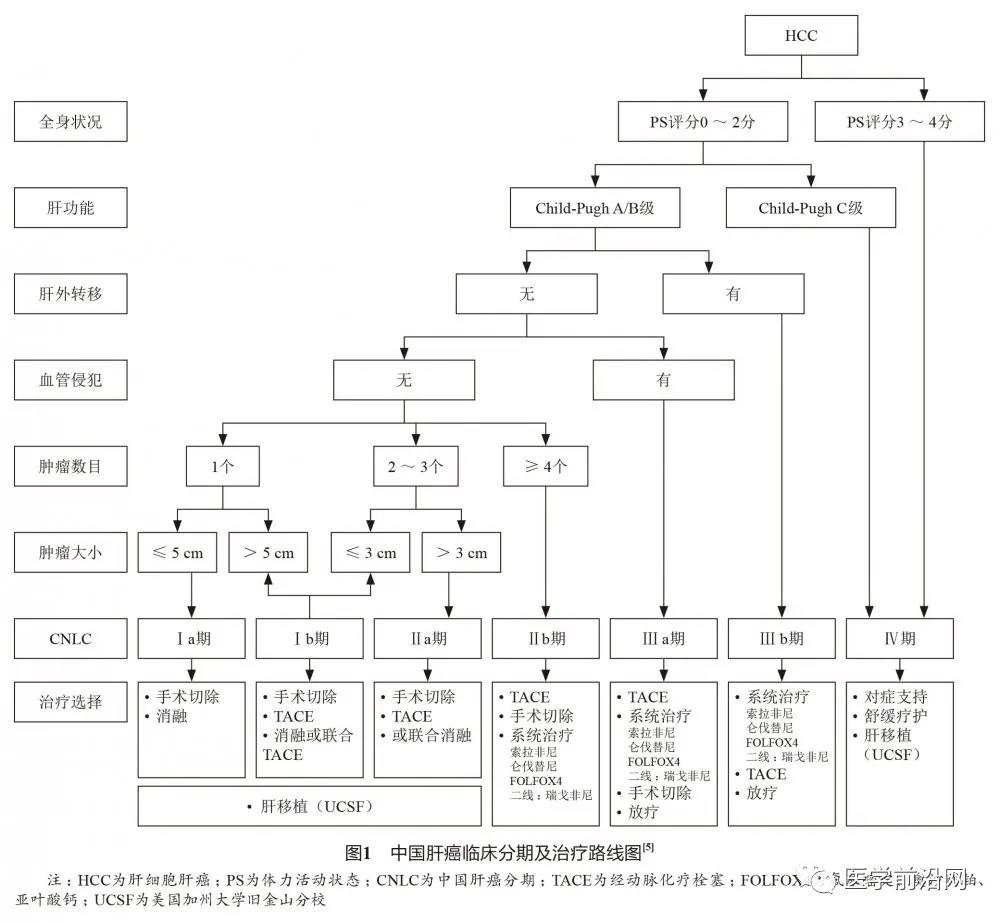 中国肝癌多学科综合治疗专家共识